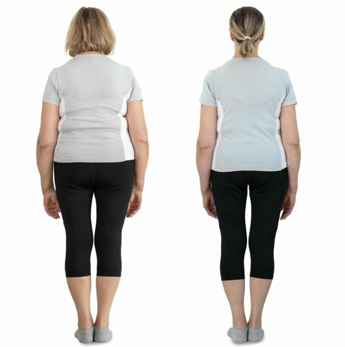 Ursula B. — flacherer Bauch nach Reishield